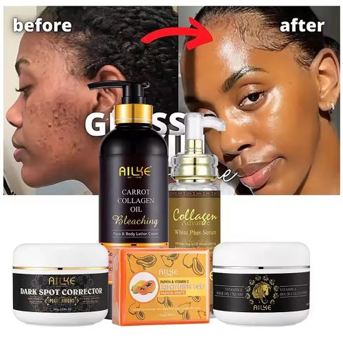 AILKE Collagen Whitening Kit, Clean Stains, Moisturizer, Hydration, Dark Spots Removal Cream, Brightening Body Lotion, Beauty AILKE Collagen Whitening Kit, Clean Stains, Moisturizer, Hydration, Dark Spots Removal Cream, Brightening Body Lotion, Beauty