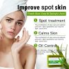 KYLIEFIT Natural Aloe Vera Soap Bar- Face, Hand, and Body Wash - Cleansing & Moisturizing, Anti Spots, Smooth Skin, 200g /7 oz